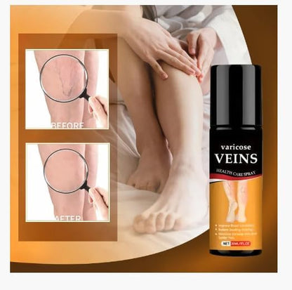 Bees Venom Spray Natural Relief For Varicose Veins & Spider Veins (Pack Of 2)