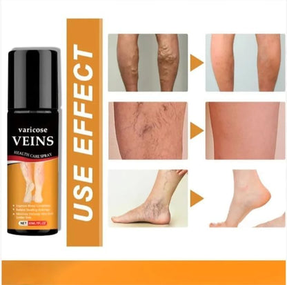 Bees Venom Spray Natural Relief For Varicose Veins & Spider Veins (Pack Of 2)