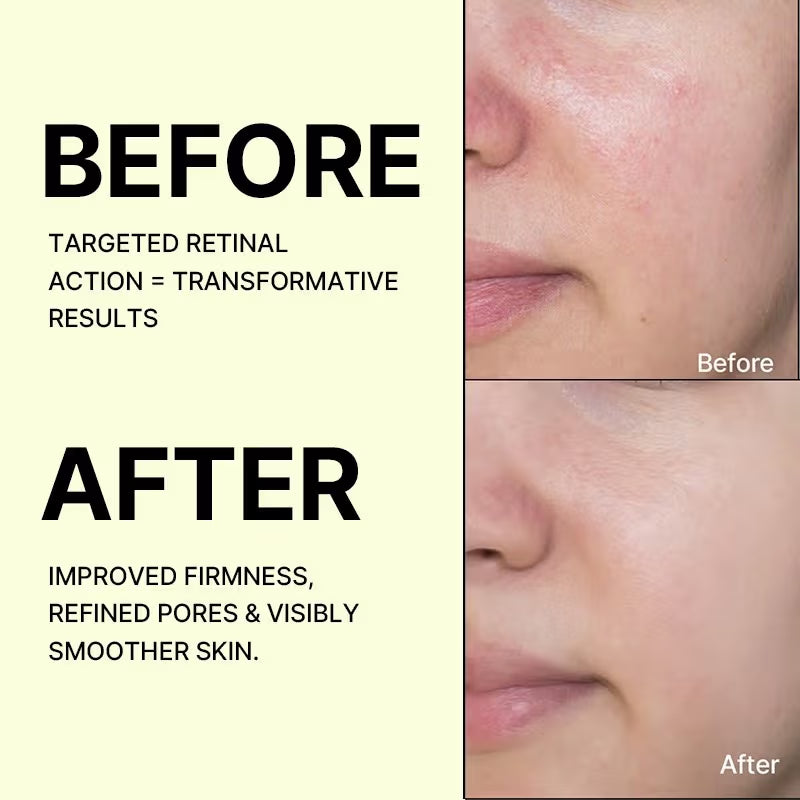 CELIMAX Vita-A Retinal Shot Tightening Booster Korean Cream