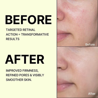 CELIMAX Vita-A Retinal Shot Tightening Booster Korean Cream
